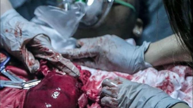 MoneyBagg Yo - 43va Heartless