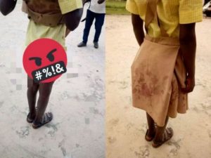 School girl left with blood stained uniform after rape by 40-year old man