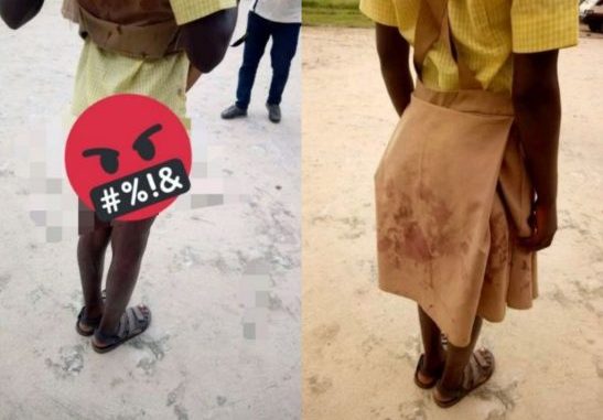 School girl left with blood stained uniform after rape by 40-year old man
